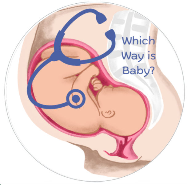 Which Way is Baby? Which Way is Baby?